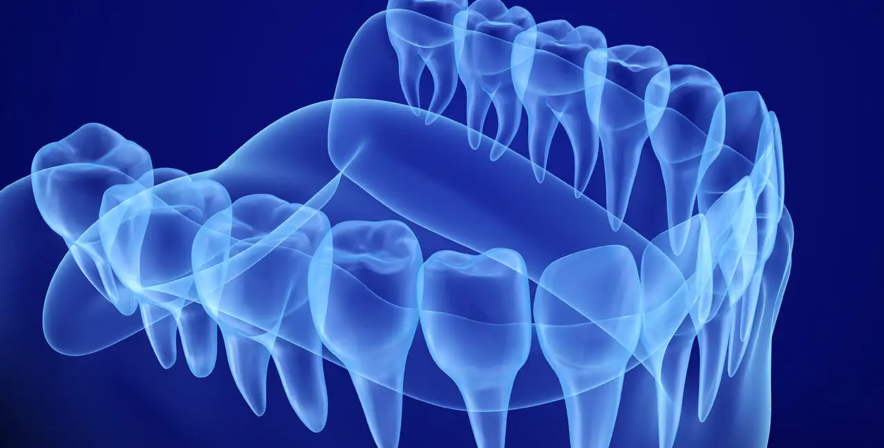 REKONSTRÜKTİF DİŞ HEKİMLİĞİ